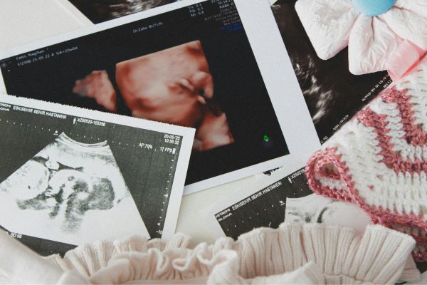 Male Infertility Treatment Indore